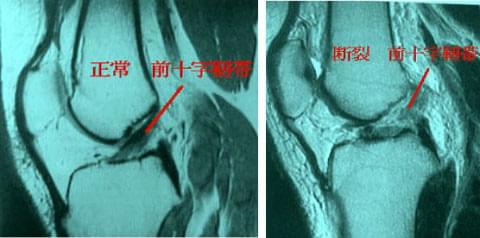 膝の疾患について 神奈川県横須賀市 医療法人社団富永整形外科